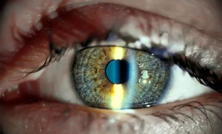 2024年中国/世界十大科技进展